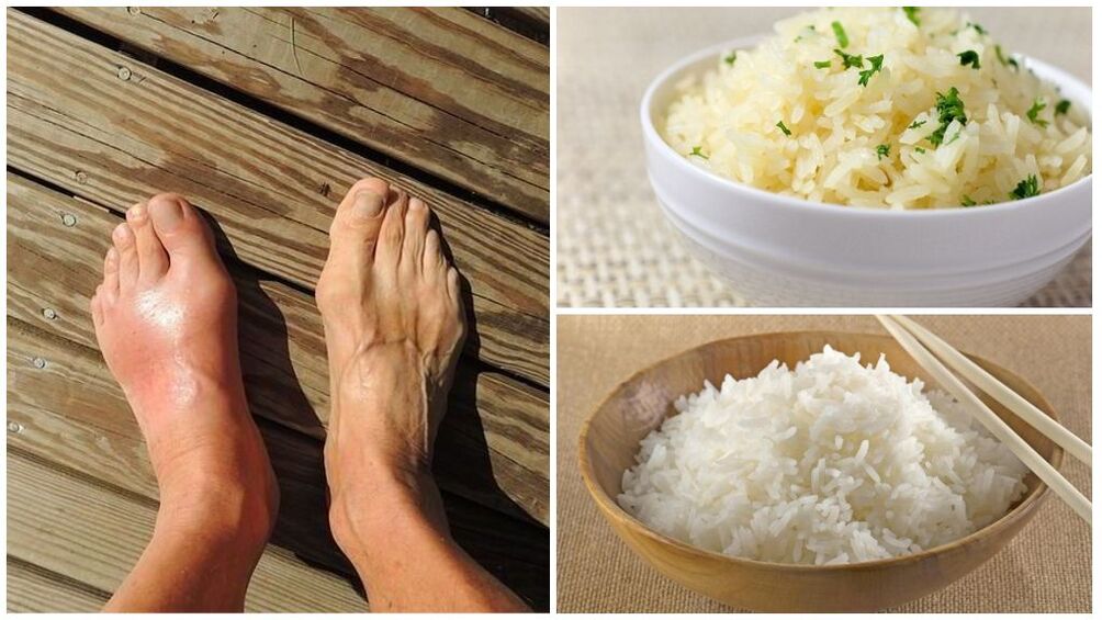 Gut hastaları için pirinç bazlı bir diyet önerilir. 
